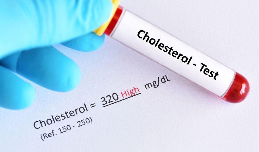 Symptoms of High Cholesterol