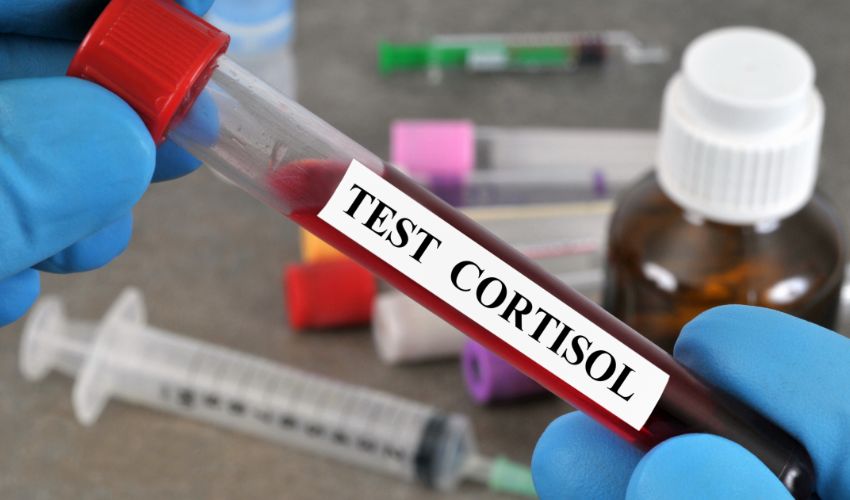 How to Lower Cortisol Levels Naturally