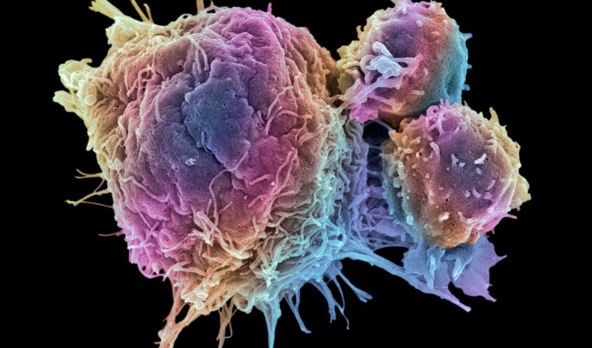 Types of Immunotherapy
