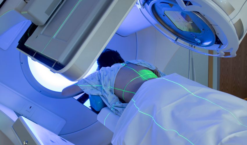 What should I expect during radiation therapy